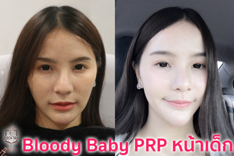 PRP the cocktail clinic พญาไท